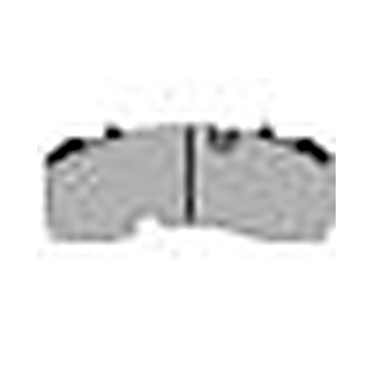 HMOE brake pad reference image enlarged from original Excel catalog row 17; confirm dimensions and fitment before ordering