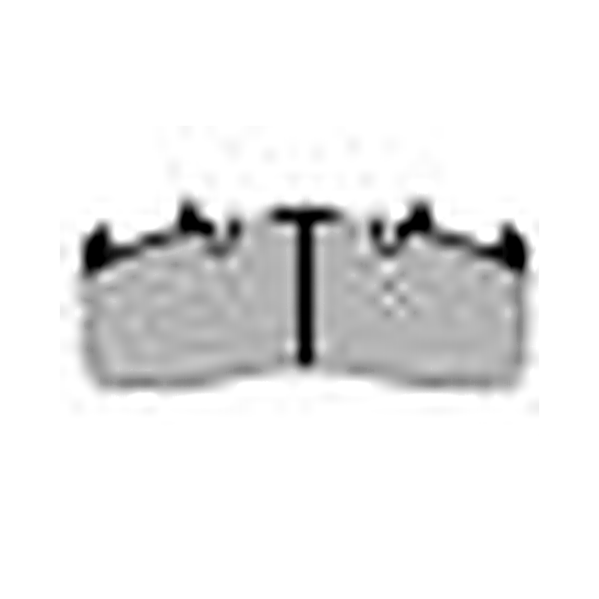 HMOE brake pad reference image enlarged from original Excel catalog row 22; confirm dimensions and fitment before ordering