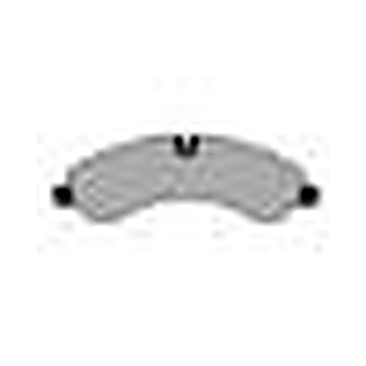 HMOE brake pad reference image enlarged from original Excel catalog row 30; confirm dimensions and fitment before ordering