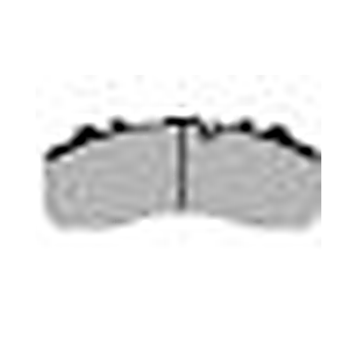 HMOE brake pad reference image enlarged from original Excel catalog row 41; confirm dimensions and fitment before ordering