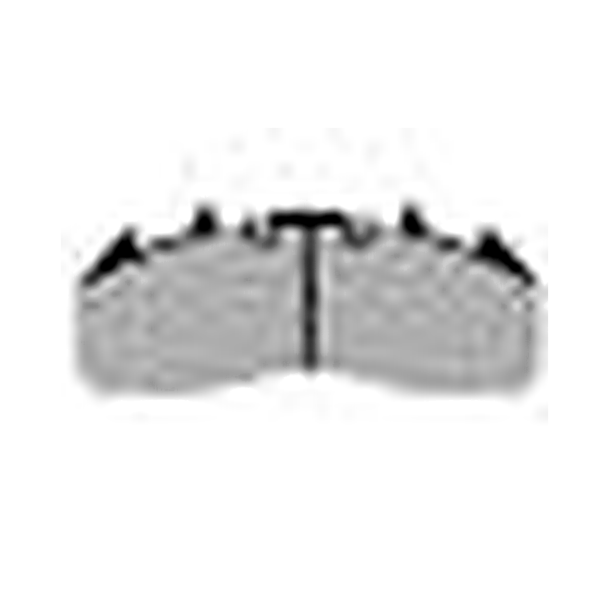 HMOE brake pad reference image enlarged from original Excel catalog row 43; confirm dimensions and fitment before ordering