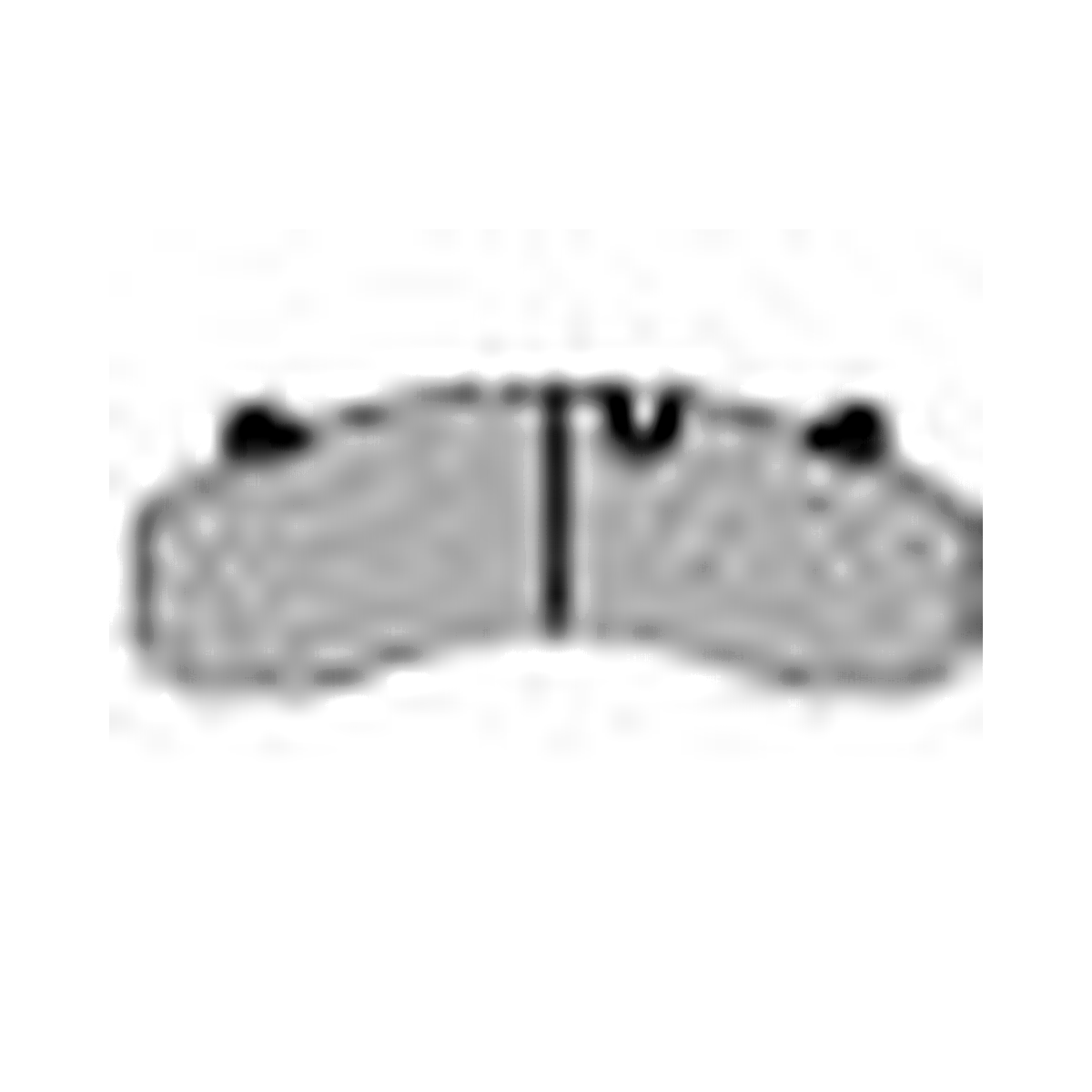 HMOE brake pad reference image enlarged from original Excel catalog row 49; confirm dimensions and fitment before ordering